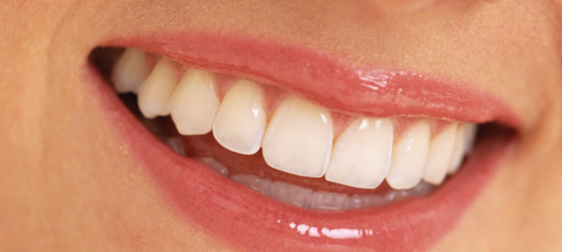 cosmetic dentist Taree 