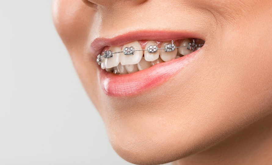 cosmetic dentist Taree