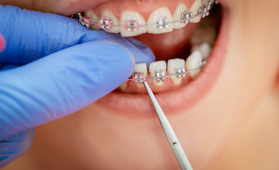 cosmetic dentist Taree 