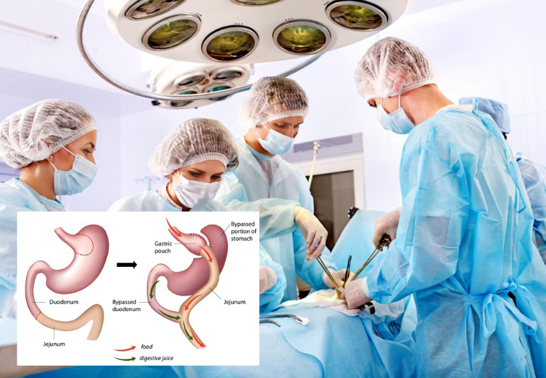 best bariatric surgeon Brisbane