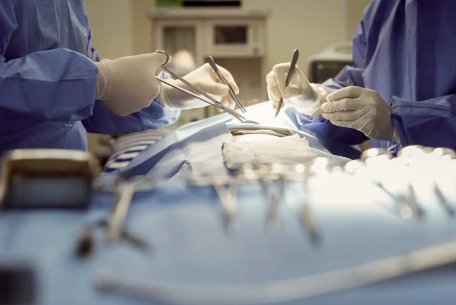 gastric sleeve operation