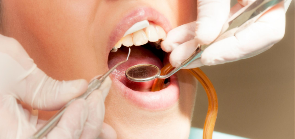 Childrens dentist Taree